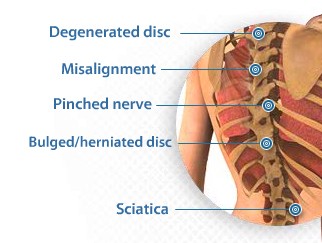 back-pain-causes